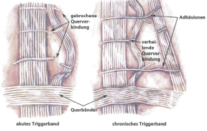 aus Orthopatische Medizin von Stephen Typaldos 